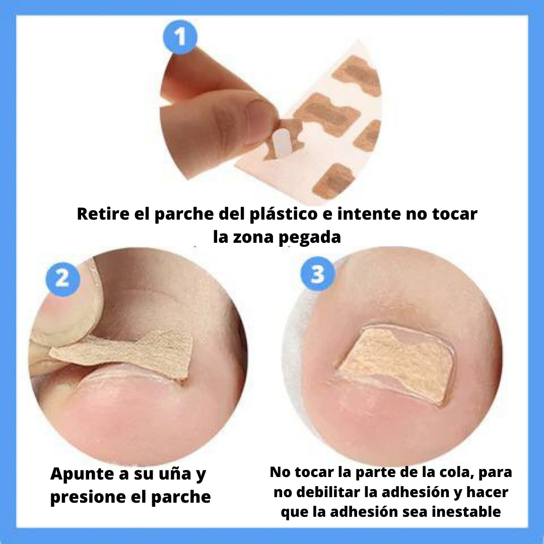 SET X 20 Nail Patch®️ parches cura uñas